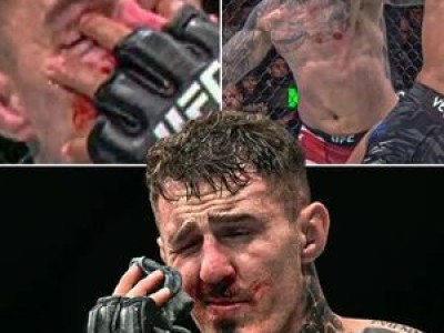 UFC 아이 포크 단속 강화 선언