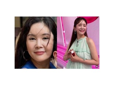 장영란 얼굴 달라졌다고 털어놓음