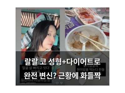 랄랄 코 성형+다이어트로 완전 변신? 근황에 화들짝